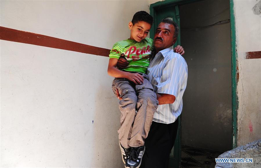 SYRIA-ALEPPO-SYRIAN BOY-PARALYSIS LEFT BY WAR