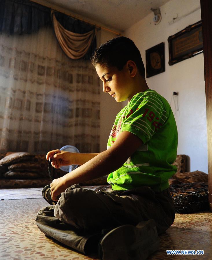 SYRIA-ALEPPO-SYRIAN BOY-PARALYSIS LEFT BY WAR