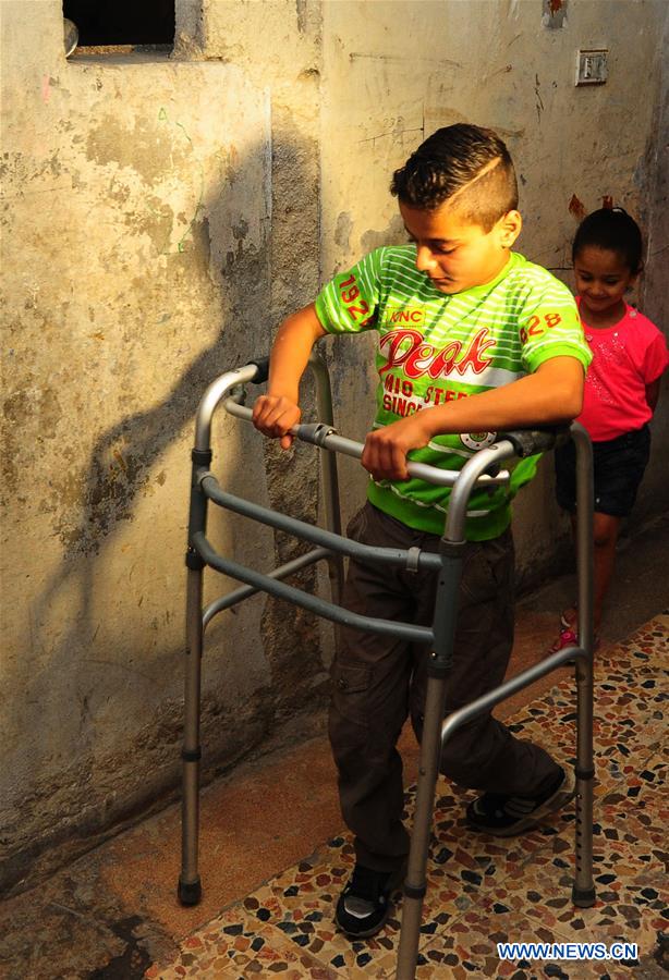 SYRIA-ALEPPO-SYRIAN BOY-PARALYSIS LEFT BY WAR