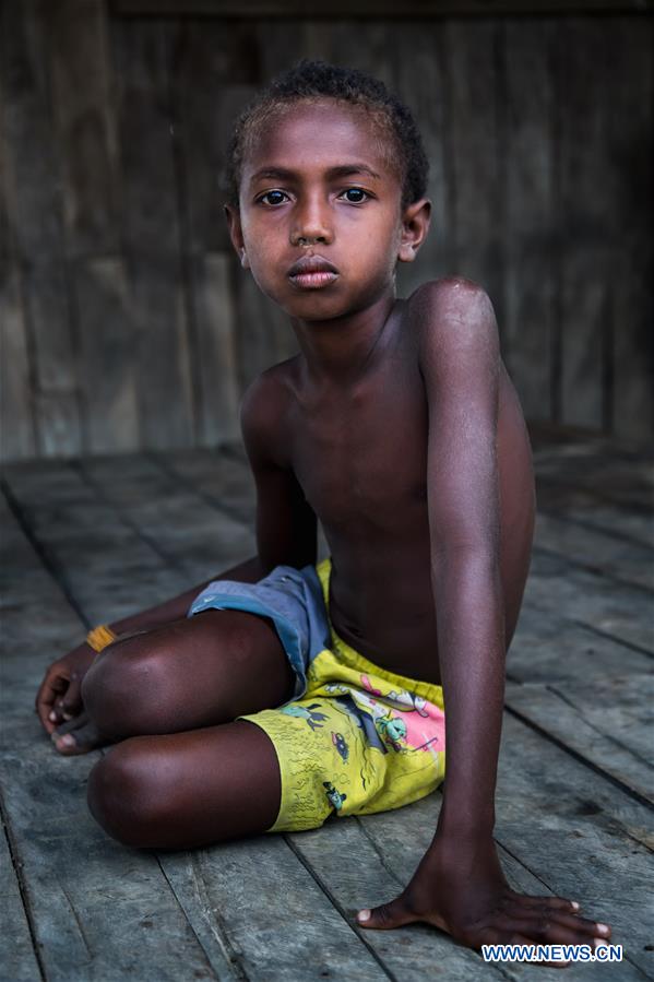 SOLOMON ISLANDS-GUADALCANAL-CHILDREN