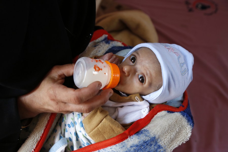 Unicef deals bottle feeding