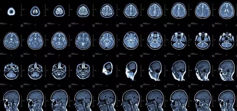 健康】CT、核磁、B超的区别，讲得太到位了！-时政频道-新华网