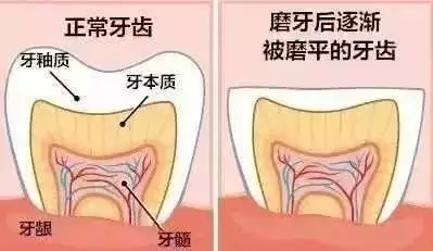 健康为什么有人睡觉会磨牙果真是肚子里有蛔虫答案在这里