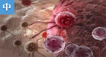 中科院专家研发出新型Ｂ细胞肿瘤抑制剂