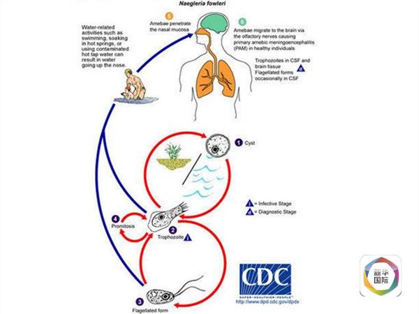 美国疾病控制和预防中心发布的福氏耐格里阿米巴原虫感染示意图.
